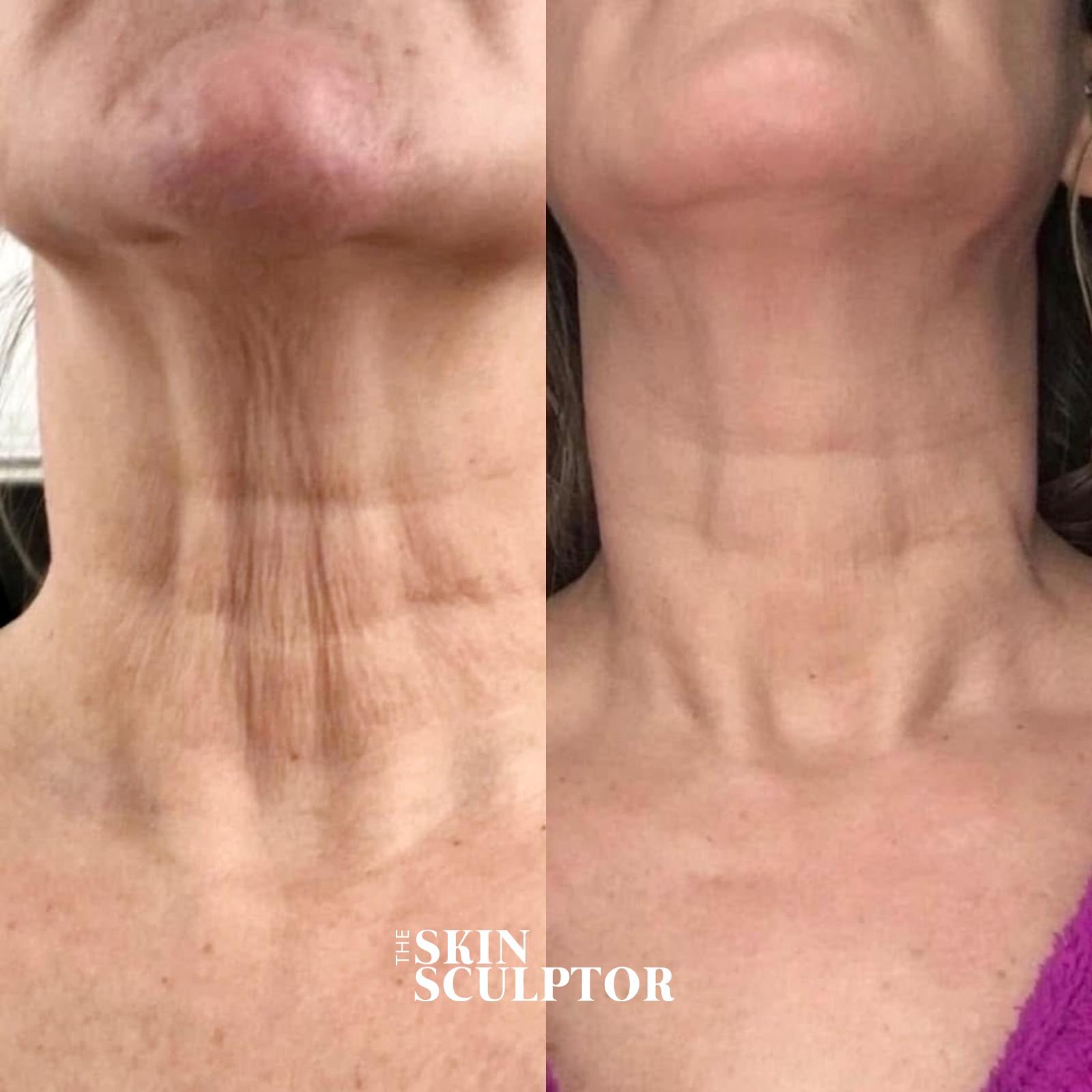 WhatsApp-Kuva 2025-10-07 klo 15.39.52_c1003675