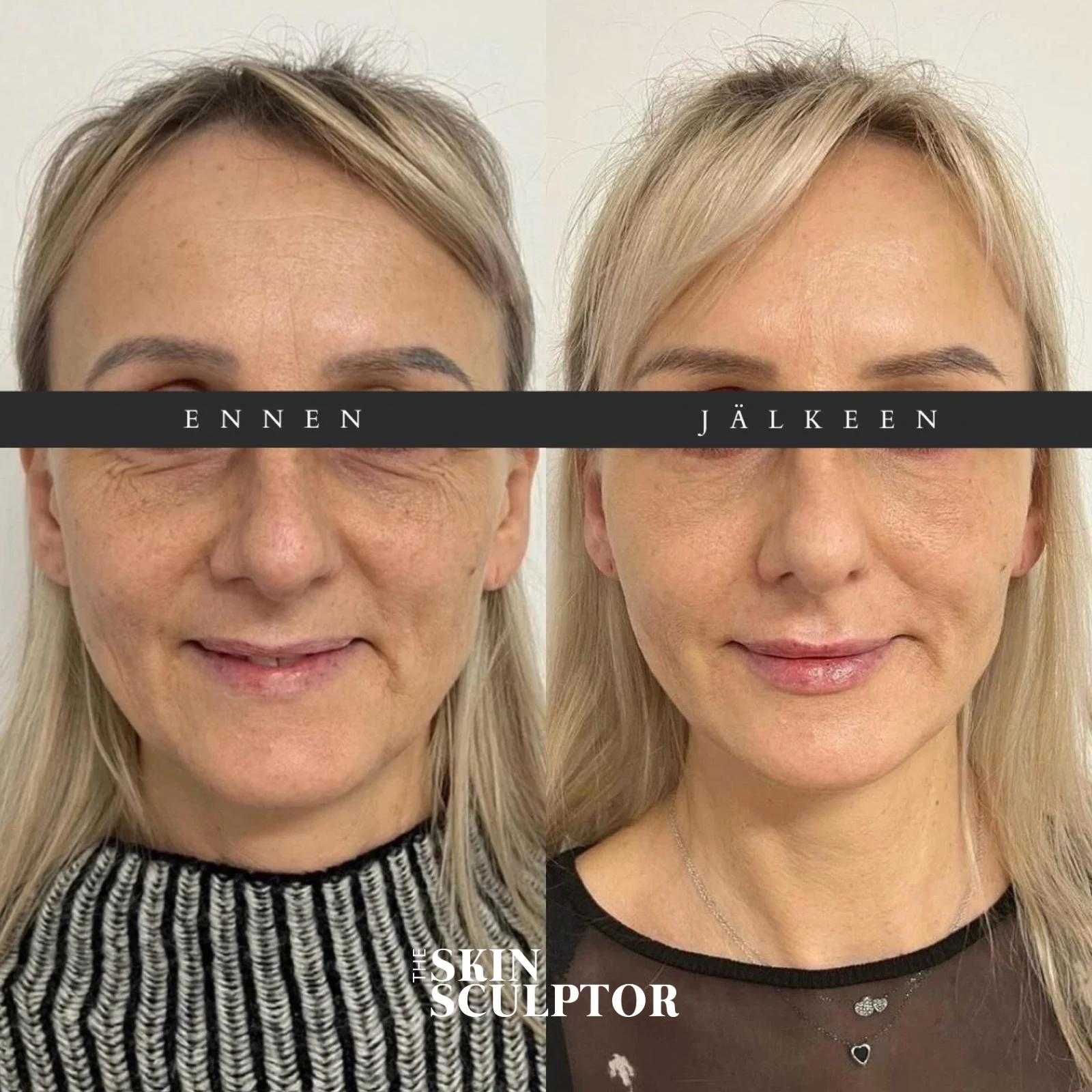 WhatsApp-Kuva 2025-10-07 klo 15.46.02_5207b177